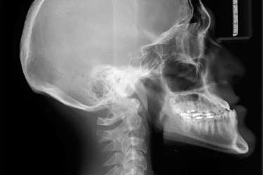 imagem de radiografia de cabeça e pescoço