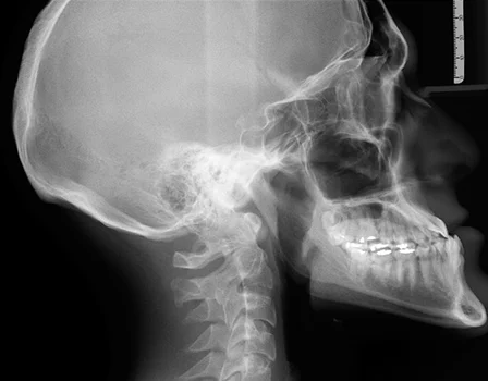 imagem de radiografia de cabeça e pescoço