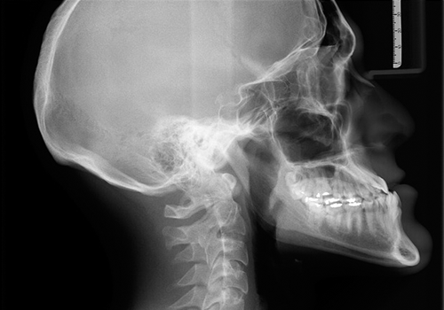 imagem de radiografia de cabeça e pescoço